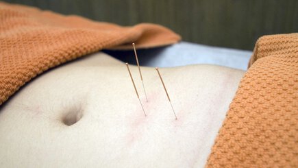 PRANIC MEDICINE - Acupuncture